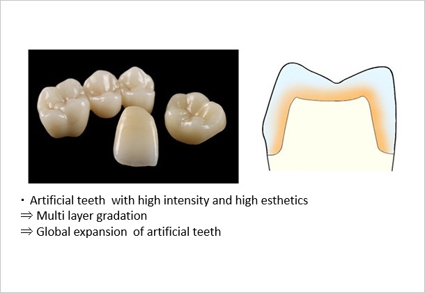 (Figure 2)Commercialization strategy of artificial teeth