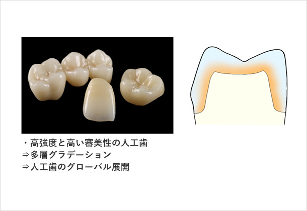 (図2)人工歯の事業化戦略